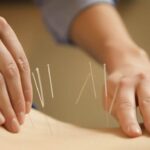 Vietnam, Japan boost cooperation in traditional medicine hinh anh 1