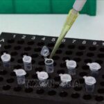 Hanoi-based children’s hospital capable of testing SARS-CoV-2 hinh anh 1