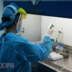 Two recovered Russian COVID-19 patients test positive again hinh anh 1