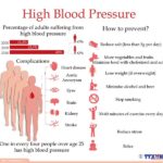 Hypertension on-the-rise poses serious health risks hinh anh 1