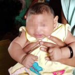 Vietnam confirms first Zika-tied birth defect case hinh anh 1